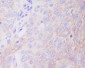 Anti-Hexokinase 1 HK1 Rabbit Monoclonal Antibody